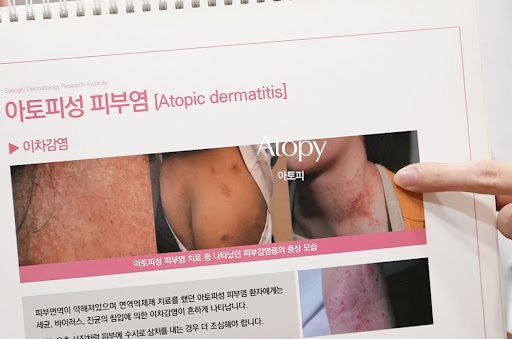 생기한의원으로 확인하는 아토피 땀과 계절 변화의 관련성